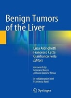 Benign Tumors Of The Liver