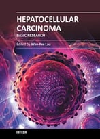 Hepatocellular Carcinoma – Basic Research By Wan-Yee Lau