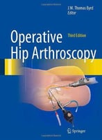 Operative Hip Arthroscopy, 3rd Edition