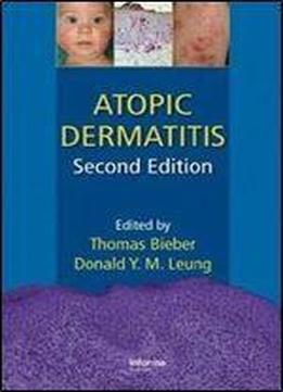 Atopic Dermatitis, Second Edition