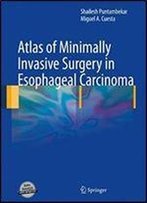 Atlas Of Minimally Invasive Surgery In Esophageal Carcinoma