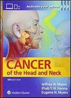 Cancer Of The Head And Neck