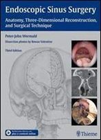 Endoscopic Sinus Surgery: Anatomy, Three-Dimensional Reconstruction, And Surgical Technique