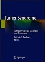 Turner Syndrome: Pathophysiology, Diagnosis And Treatment