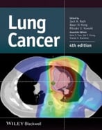 Lung Cancer, 4th Edition