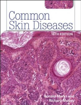 Common Skin Diseases (18Th Edition)