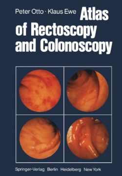 Atlas Of Rectoscopy And Coloscopy