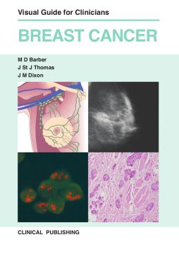 Breast Cancer: Visual Guide For Clinicians