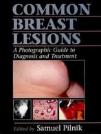 Common Breast Lesions: A Photographic Guide To Diagnosis And Treatment