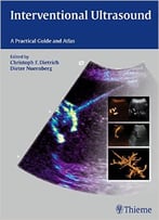 Interventional Ultrasound : Practical Guide And Atlas