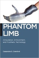 Phantom Limb – Amputation, Embodiment, And Prosthetic Technology