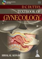 D C Dutta’S Textbook Of Gynecology, 6th Edition