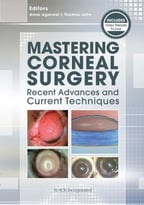 Mastering Corneal Surgery: Recent Advances And Current Techniques