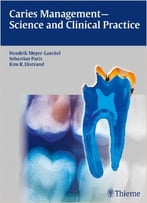 Caries Management – Science And Clinical Practice
