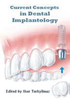 Current Concepts In Dental Implantology