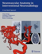 Neurovascular Anatomy In Interventional Neuroradiology: A Case-Based Approach