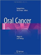 Oral Cancer: Diagnosis And Therapy