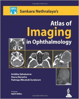 Sankara Nethralaya’S Atlas Of Imaging In Ophthalmology