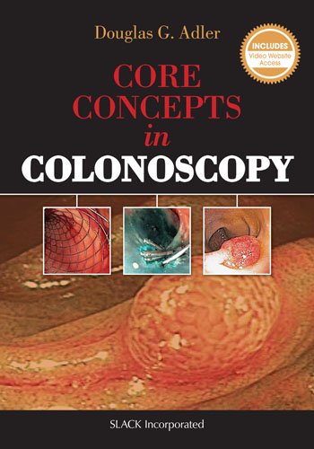 Core Concepts In Colonoscopy