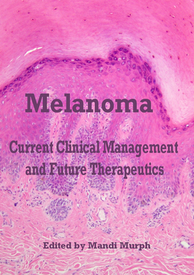 Melanoma: Current Clinical Management And Future Therapeutics Ed. By Mandi Murph
