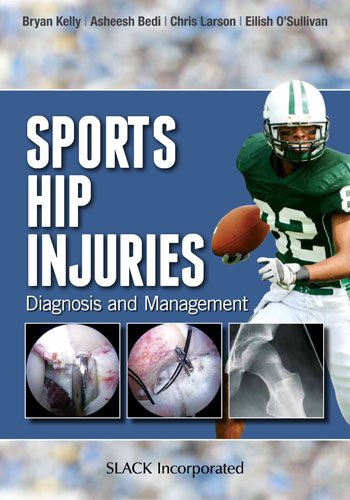 Sports Hip Injuries: Diagnosis And Management