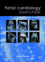 Fetal Cardiology Simplified: A Practical Manual