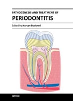 Pathogenesis And Treatment Of Periodontitis By Nurcan Buduneli