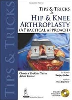 Tips And Tricks In Hip And Knee Arthroplasty