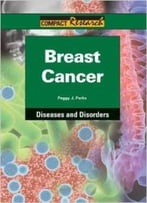 Breast Cancer (Compact Research: Diseases & Disorders) By Peggy J. Parks