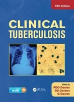 Clinical Tuberculosis (5th Edition)