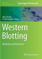 Western Blotting: Methods And Protocols