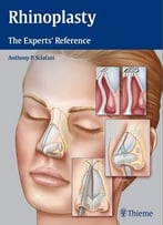 Rhinoplasty: The Experts’ Reference