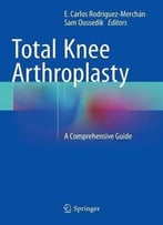 Total Knee Arthroplasty: A Comprehensive Guide