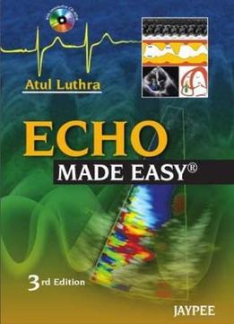 Echo Made Easy (3Rd Edition)
