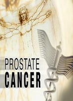 Management Of Prostate Cancer: Advances And Controversies By Kenneth B. Cummings
