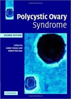 Polycystic Ovary Syndrome, 2nd Edition