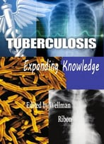 Tuberculosis: Expanding Knowledge Ed. By Wellman Ribon