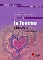 Anne Tardivon, Marc Bazot, Imagerie De La Femme : Sénologie