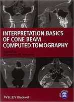 Interpretation Basics Of Cone Beam Computed Tomography