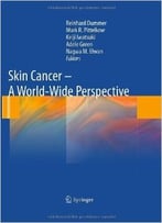 Skin Cancer – A World-Wide Perspective