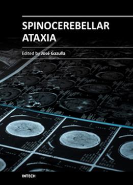 Spinocerebellar Ataxia By Jose Gazulla