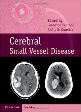 Cerebral Small Vessel Disease