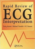 Rapid Review Of Ecg Interpretation
