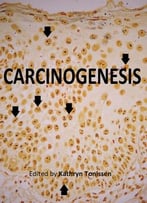 Carcinogenesis Ed. By Kathryn Tonissen
