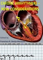 Cardiac Arrhythmias: New Considerations Ed. By Francisco R. Breijo-Marquez