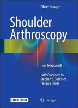 Shoulder Arthroscopy: How To Succeed!