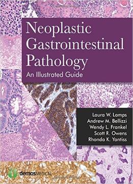 Neoplastic Gastrointestinal Pathology