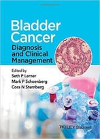 Bladder Cancer Diagnosis And Clinical Management