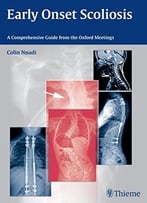 Early Onset Scoliosis: A Comprehensive Guide From The Oxford Meetings