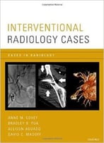 Interventional Radiology Cases (Cases In Radiology)
